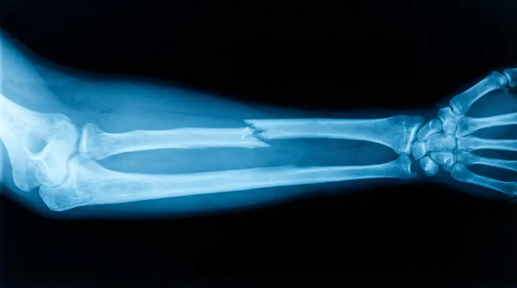 Broken Enterprise Software Implementation