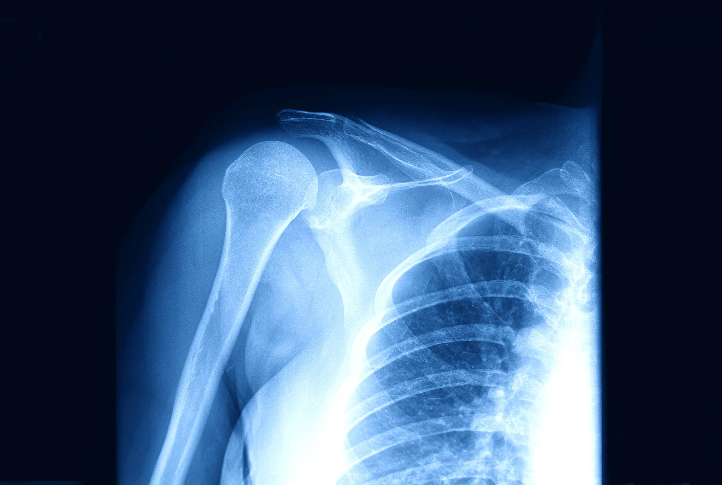 Broken Enterprise Software Implementation